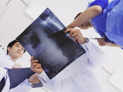 Doctor and medical assistants discussing about diagnosis result on x-ray film.